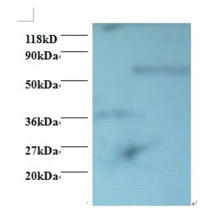 Programmed cell death protein 6 Polyclonal Antibody from Signalway Antibody (42418) - Antibodies.com