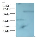 Programmed cell death protein 6 Polyclonal Antibody from Signalway Antibody (42418) - Antibodies.com