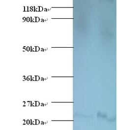 Bis (5'-adenosyl)-triphosphatase Polyclonal Antibody from Signalway Antibody (42542) - Antibodies.com