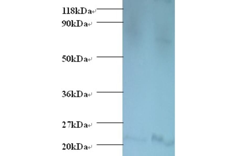 Bis (5'-adenosyl)-triphosphatase Polyclonal Antibody from Signalway Antibody (42542) - Antibodies.com