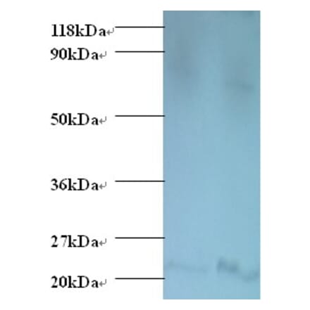 Bis (5'-adenosyl)-triphosphatase Polyclonal Antibody from Signalway Antibody (42542) - Antibodies.com