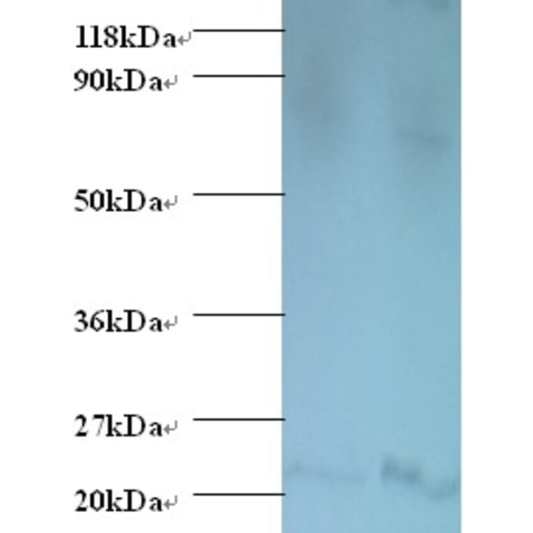 Bis (5'-adenosyl)-triphosphatase Polyclonal Antibody from Signalway Antibody (42542) - Antibodies.com