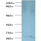 Bis (5'-adenosyl)-triphosphatase Polyclonal Antibody from Signalway Antibody (42542) - Antibodies.com