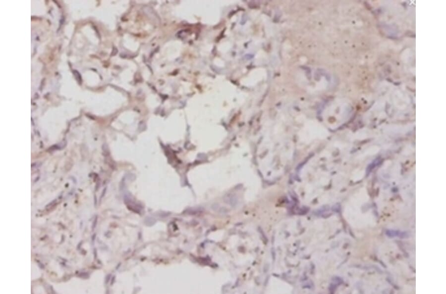 Immunohistochemistry - Hypoxia-inducible factor 1-alphaPolyclonal Antibody from Signalway Antibody (42562)