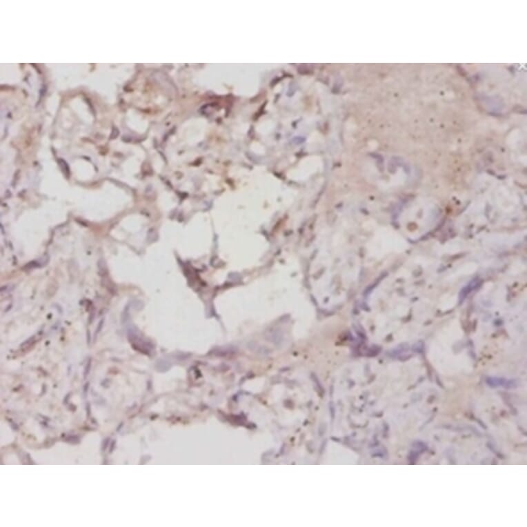 Immunohistochemistry - Hypoxia-inducible factor 1-alphaPolyclonal Antibody from Signalway Antibody (42562)