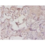 Immunohistochemistry - Hypoxia-inducible factor 1-alphaPolyclonal Antibody from Signalway Antibody (42562)