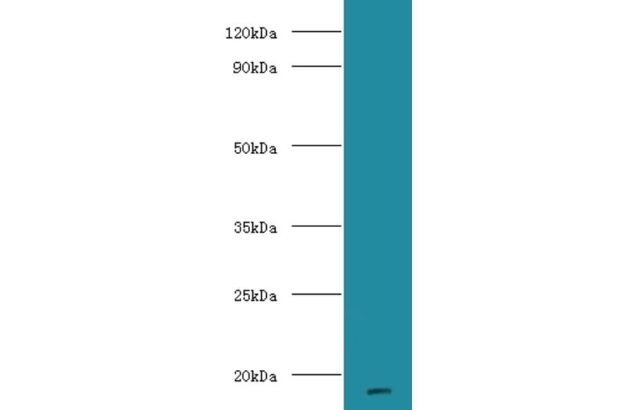 Major urinary proteins 11 and 8 Polyclonal Antibody from Signalway Antibody (42636) - Antibodies.com