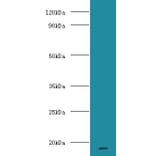 Major urinary proteins 11 and 8 Polyclonal Antibody from Signalway Antibody (42636) - Antibodies.com