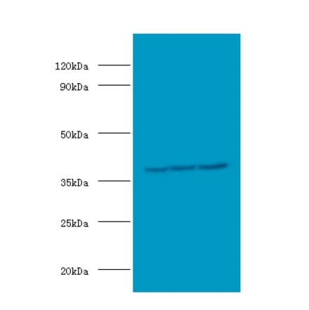 Casein kinase II subunit alpha' Polyclonal Antibody from Signalway Antibody (42639) - Antibodies.com