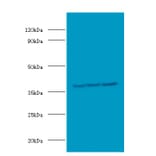 Casein kinase II subunit alpha' Polyclonal Antibody from Signalway Antibody (42639) - Antibodies.com