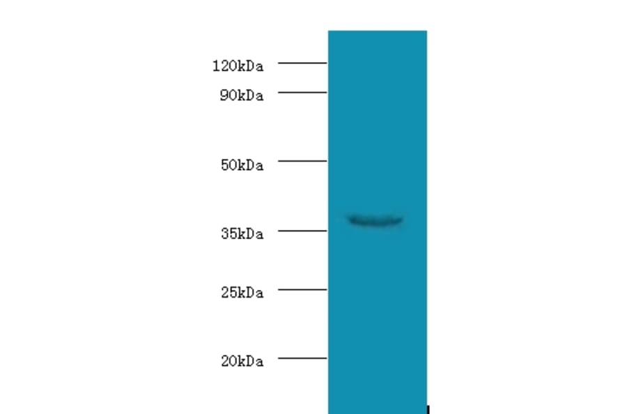WD repeat-containing protein 54 Polyclonal Antibody from Signalway Antibody (42687) - Antibodies.com