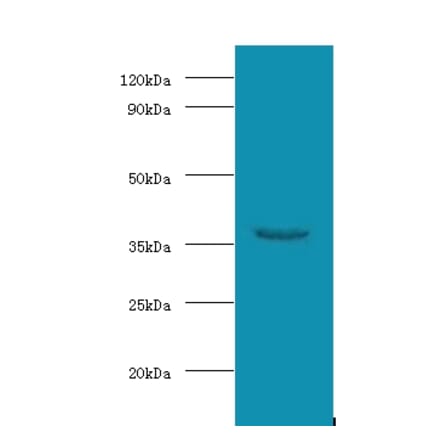 WD repeat-containing protein 54 Polyclonal Antibody from Signalway Antibody (42687) - Antibodies.com