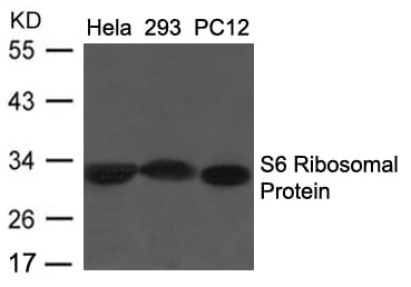 Western blot analysis of extracts from Hela, 293 and PC12 cells using S6 Ribosomal Protein (Ab-235/236) Antibody #21682.