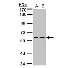 coiled-coil domain containing 102B antibody from Signalway Antibody (23151) - Antibodies.com