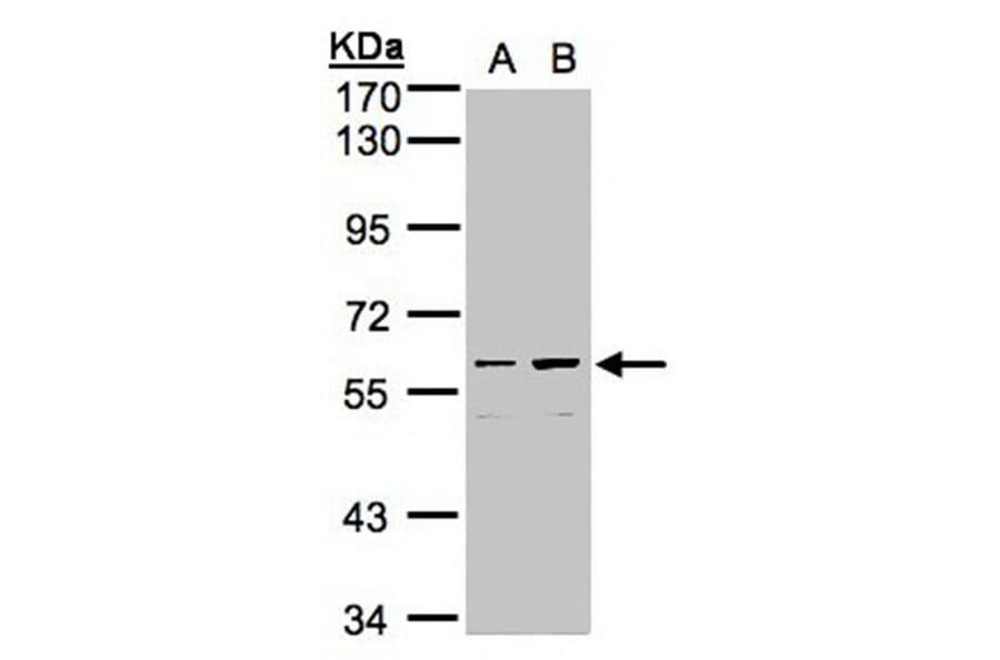 coiled-coil domain containing 102B antibody from Signalway Antibody (23151) - Antibodies.com