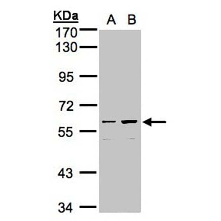 coiled-coil domain containing 102B antibody from Signalway Antibody (23151) - Antibodies.com