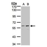coiled-coil domain containing 102B antibody from Signalway Antibody (23151) - Antibodies.com