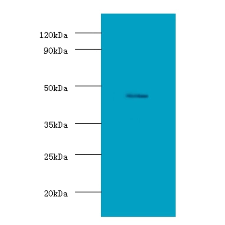 Protein delta homolog 1 Polyclonal Antibody from Signalway Antibody (42148) - Antibodies.com