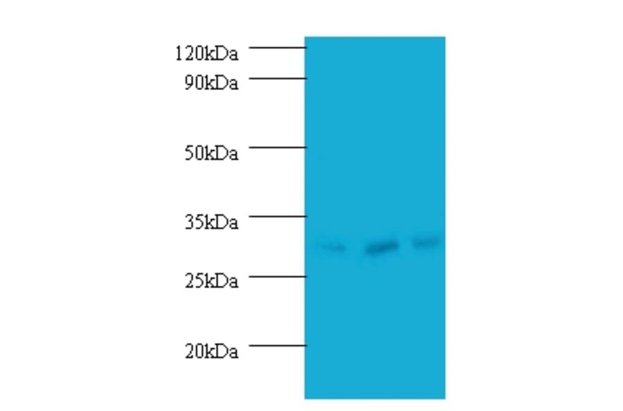 Checkpoint protein HUS1 Polyclonal Antibody from Signalway Antibody (42214) - Antibodies.com