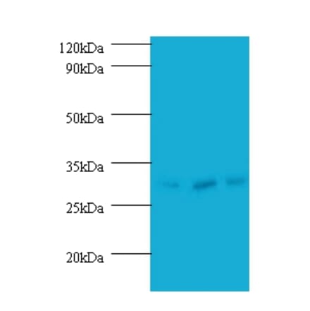 Checkpoint protein HUS1 Polyclonal Antibody from Signalway Antibody (42214) - Antibodies.com
