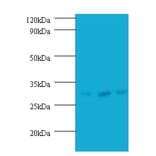 Checkpoint protein HUS1 Polyclonal Antibody from Signalway Antibody (42214) - Antibodies.com