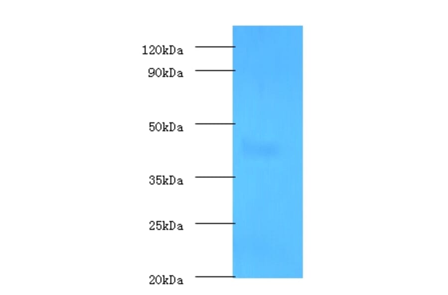Protein-lysine 6-oxidas Polyclonal Antibody from Signalway Antibody (42240) - Antibodies.com