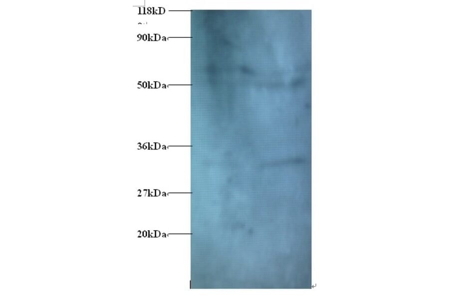 Zinc finger protein 384 Polyclonal Antibody from Signalway Antibody (42393) - Antibodies.com