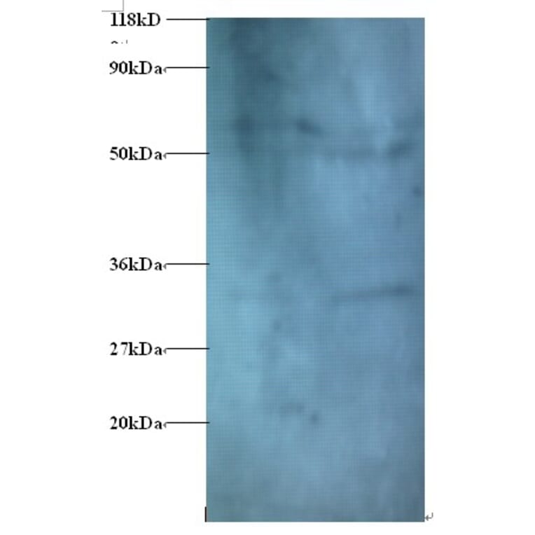 Zinc finger protein 384 Polyclonal Antibody from Signalway Antibody (42393) - Antibodies.com