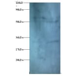 Zinc finger protein 384 Polyclonal Antibody from Signalway Antibody (42393) - Antibodies.com