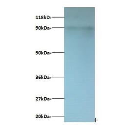 C-X-C motif chemokine 5 Polyclonal Antibody from Signalway Antibody (42451) - Antibodies.com