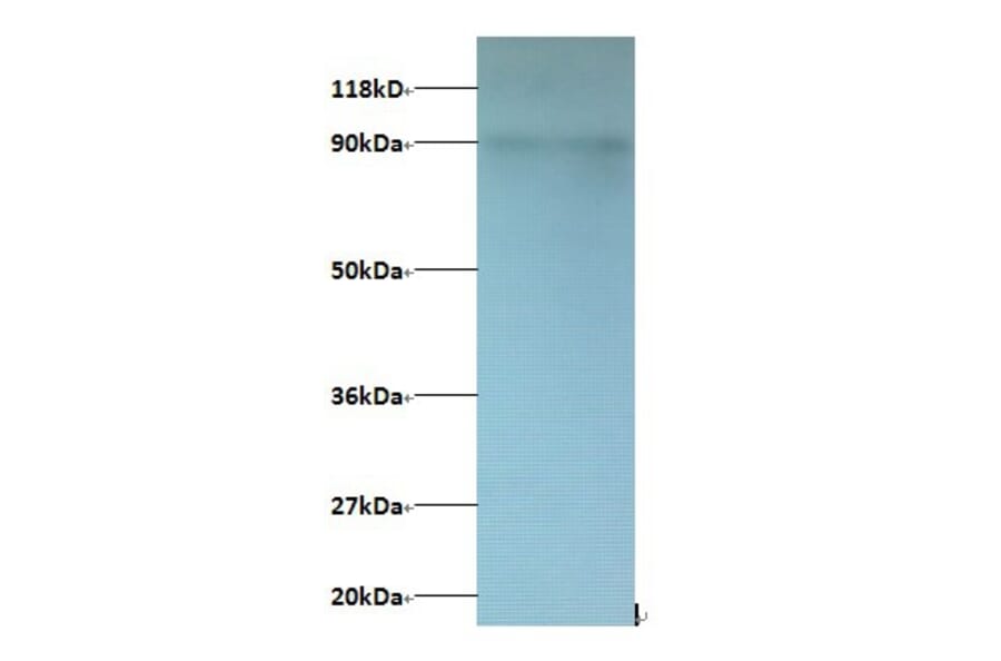 C-X-C motif chemokine 5 Polyclonal Antibody from Signalway Antibody (42451) - Antibodies.com