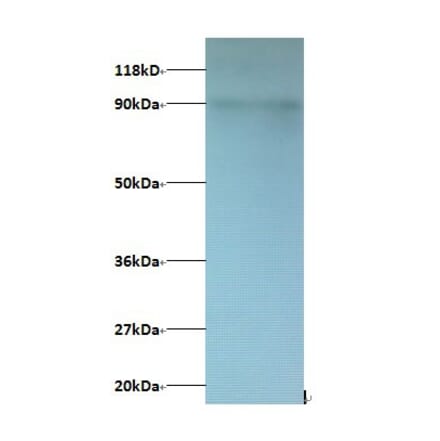 C-X-C motif chemokine 5 Polyclonal Antibody from Signalway Antibody (42451) - Antibodies.com