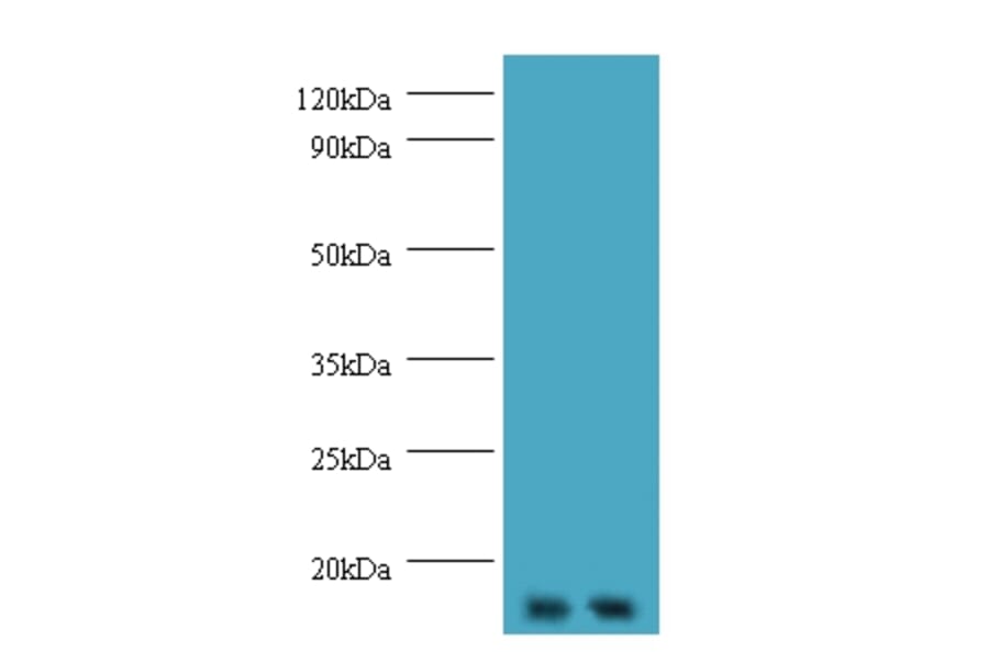 Gem-associated protein 7 polyclona Antibody from Signalway Antibody (42674) - Antibodies.com