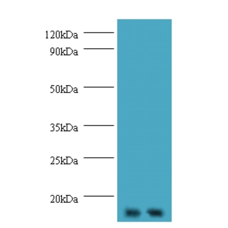 Gem-associated protein 7 polyclona Antibody from Signalway Antibody (42674) - Antibodies.com