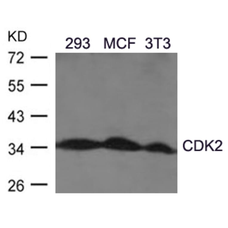 Western blot - CDK2 (Ab-160) Antibody from Signalway Antibody (21111) - Antibodies.com