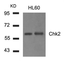 Western blot - Chk2 (Ab-516) Antibody from Signalway Antibody (21117) - Antibodies.com