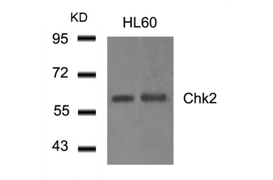 Western blot - Chk2 (Ab-516) Antibody from Signalway Antibody (21117) - Antibodies.com