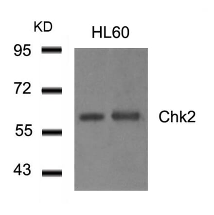Western blot - Chk2 (Ab-516) Antibody from Signalway Antibody (21117) - Antibodies.com