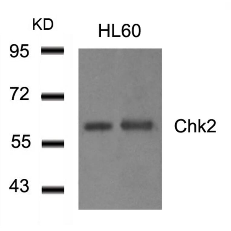 Western blot - Chk2 (Ab-516) Antibody from Signalway Antibody (21117) - Antibodies.com