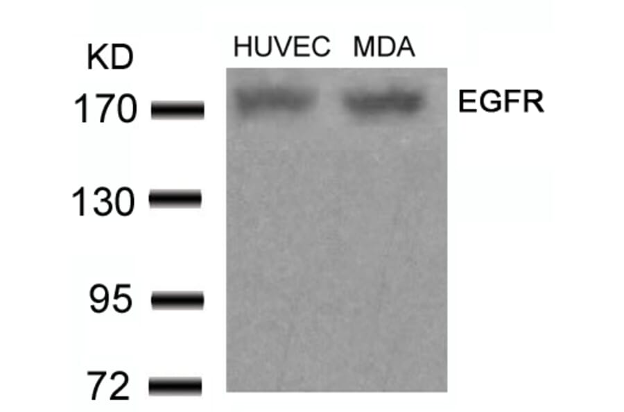 Western blot - EGFR (Ab-678) Antibody from Signalway Antibody (21193) - Antibodies.com