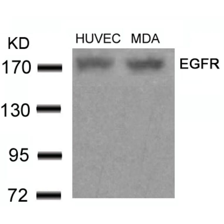 Western blot - EGFR (Ab-678) Antibody from Signalway Antibody (21193) - Antibodies.com