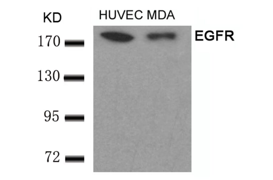 Western blot - EGFR (Ab-693) Antibody from Signalway Antibody (21194) - Antibodies.com
