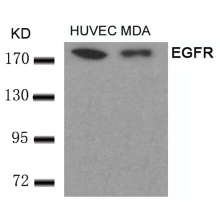Western blot - EGFR (Ab-693) Antibody from Signalway Antibody (21194) - Antibodies.com