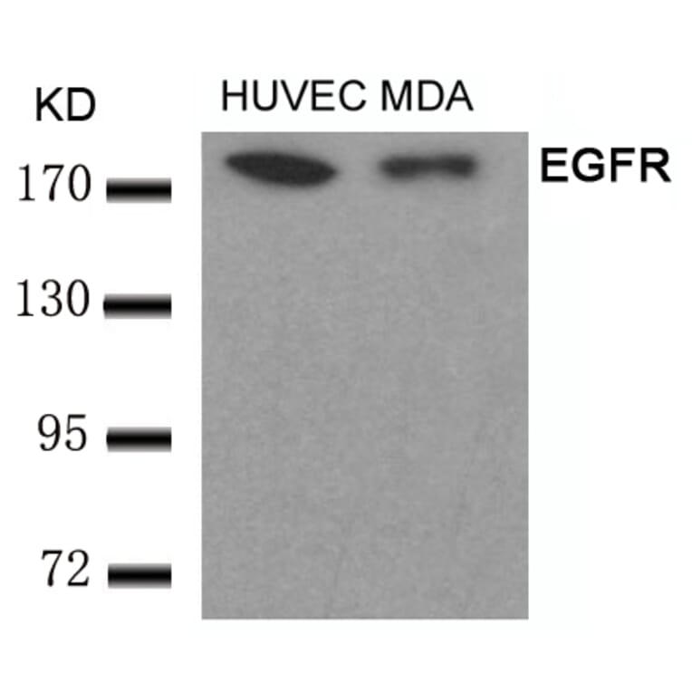 Western blot - EGFR (Ab-693) Antibody from Signalway Antibody (21194) - Antibodies.com