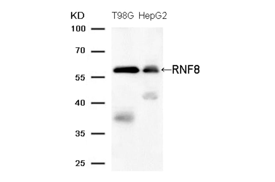 Western blot - RNF8 (Ab-137) Antibody from Signalway Antibody (21699) - Antibodies.com