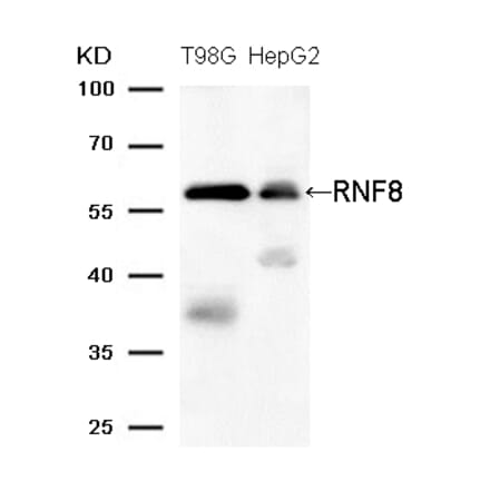 Western blot - RNF8 (Ab-137) Antibody from Signalway Antibody (21699) - Antibodies.com