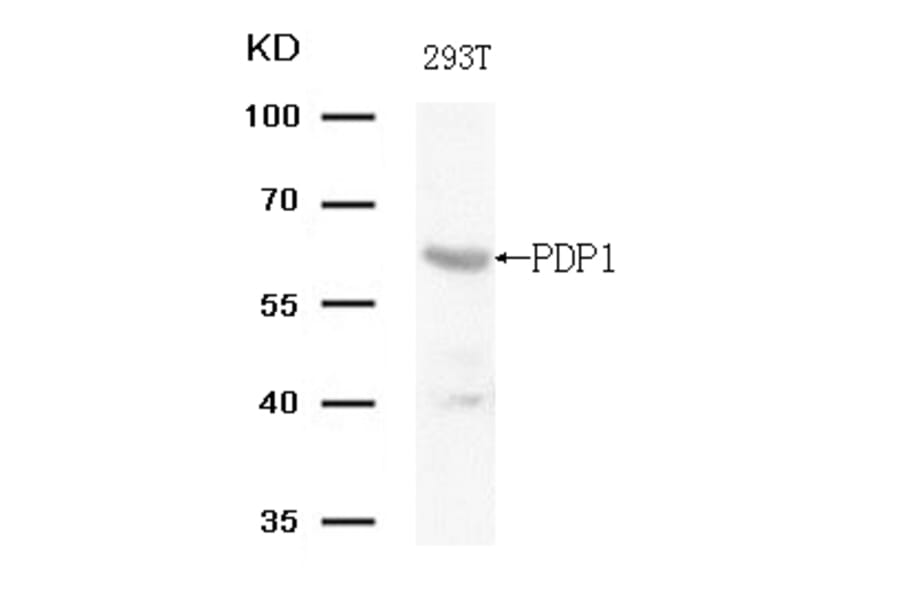 Western blot - PDP1 (Ab-381) Antibody from Signalway Antibody (21703) - Antibodies.com