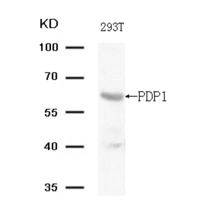 Western blot - PDP1 (Ab-381) Antibody from Signalway Antibody (21703) - Antibodies.com