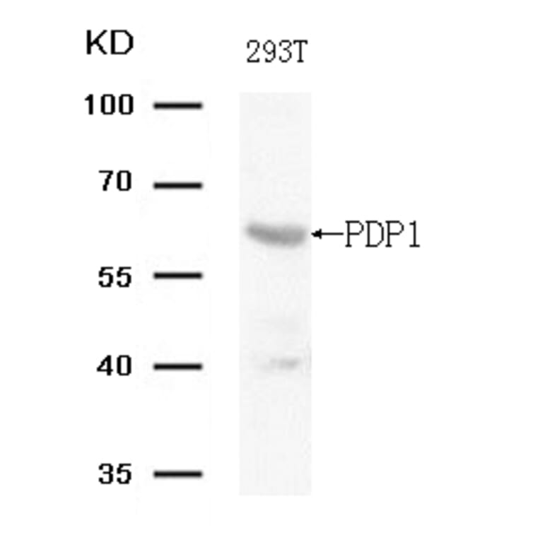 Western blot - PDP1 (Ab-381) Antibody from Signalway Antibody (21703) - Antibodies.com