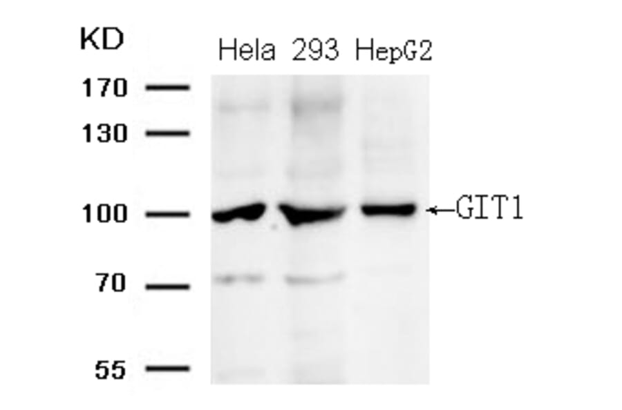 Western blot - GIT1 (Ab-383) Antibody from Signalway Antibody (21707) - Antibodies.com